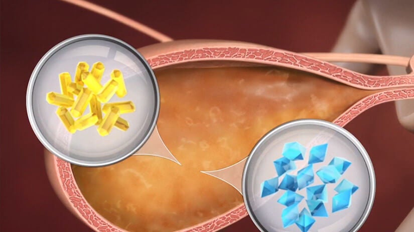 PPVD Feline UR StOx FLUTD Video